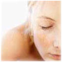 ��� Melasma